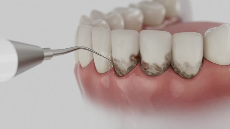 Reliable Wisdom Tooth Removal contractor in Charlottesville city County, VA by Dentist Open Now
